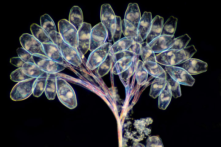 Vorticella