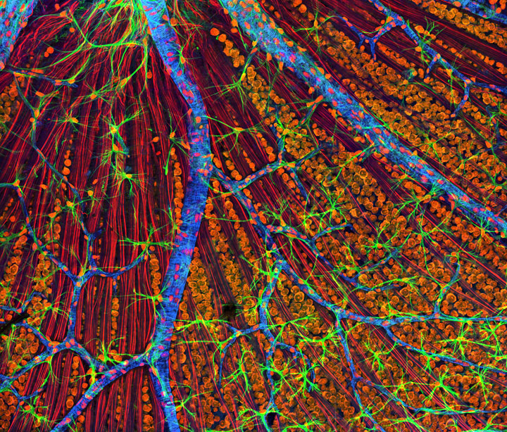 Mouse Retina 